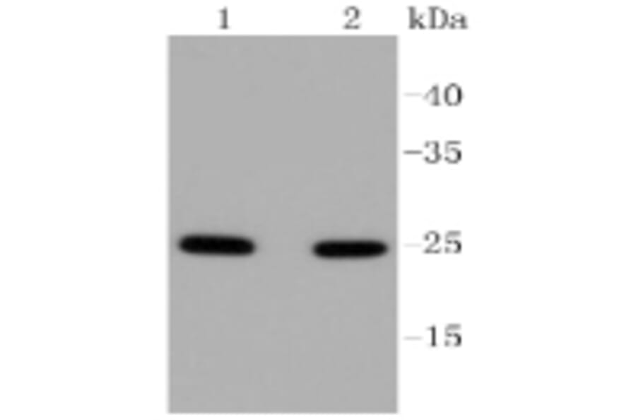 Anti-RAB5A Antibody from Bioworld Technology (BS9926M) - Antibodies.com