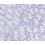 Anti-PI3K p85β Antibody from Bioworld Technology (BS9928M) - Antibodies.com