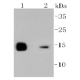 Anti-LYZ Antibody from Bioworld Technology (BS9932M) - Antibodies.com