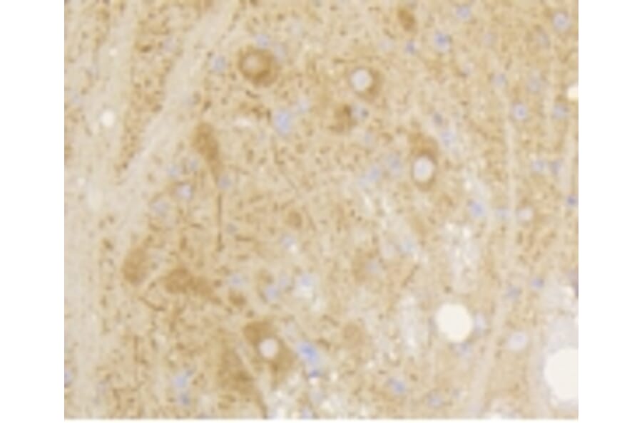 Anti-mGluR-5 Antibody from Bioworld Technology (BS9933M) - Antibodies.com