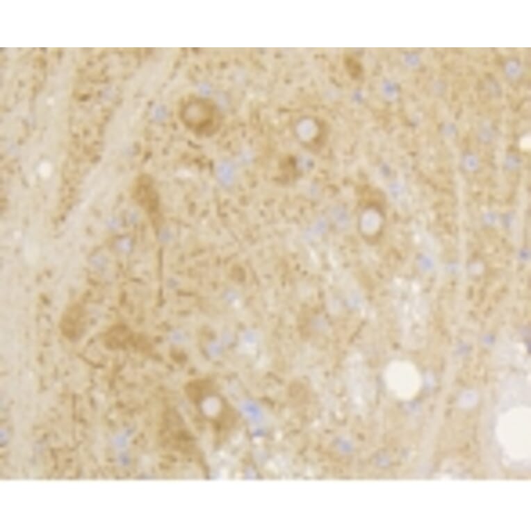 Anti-mGluR-5 Antibody from Bioworld Technology (BS9933M) - Antibodies.com