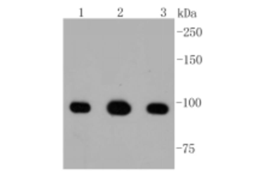 Anti-ATP-Citrate Lyase Antibody from Bioworld Technology (BS9934M) - Antibodies.com