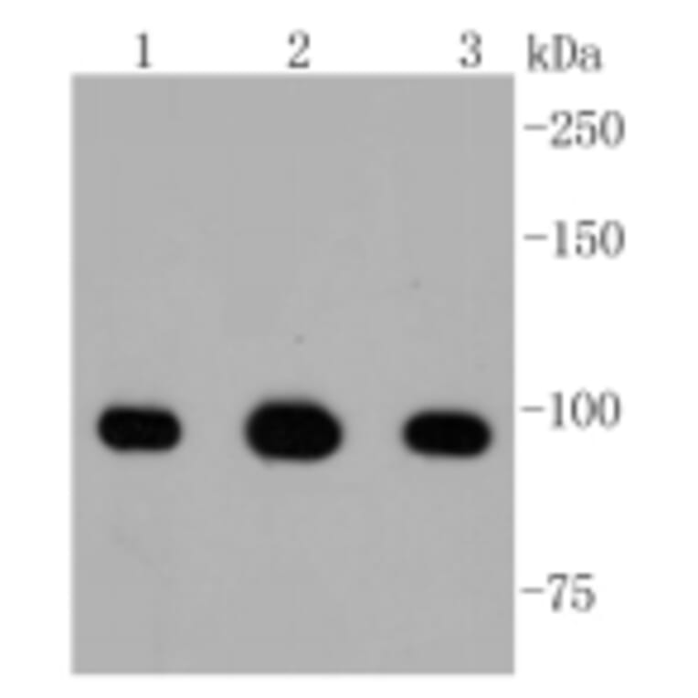 Anti-ATP-Citrate Lyase Antibody from Bioworld Technology (BS9934M) - Antibodies.com