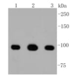 Anti-ATP-Citrate Lyase Antibody from Bioworld Technology (BS9934M) - Antibodies.com