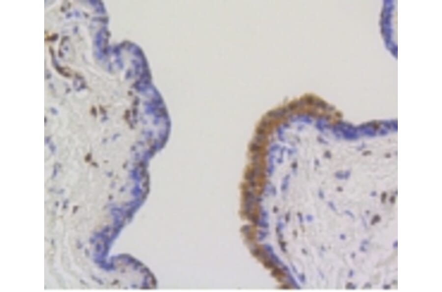 Anti-ATP-Citrate Lyase Antibody from Bioworld Technology (BS9934M) - Antibodies.com
