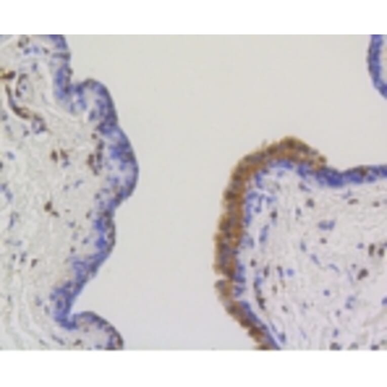 Anti-ATP-Citrate Lyase Antibody from Bioworld Technology (BS9934M) - Antibodies.com