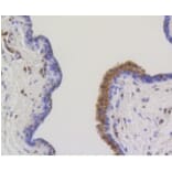 Anti-ATP-Citrate Lyase Antibody from Bioworld Technology (BS9934M) - Antibodies.com