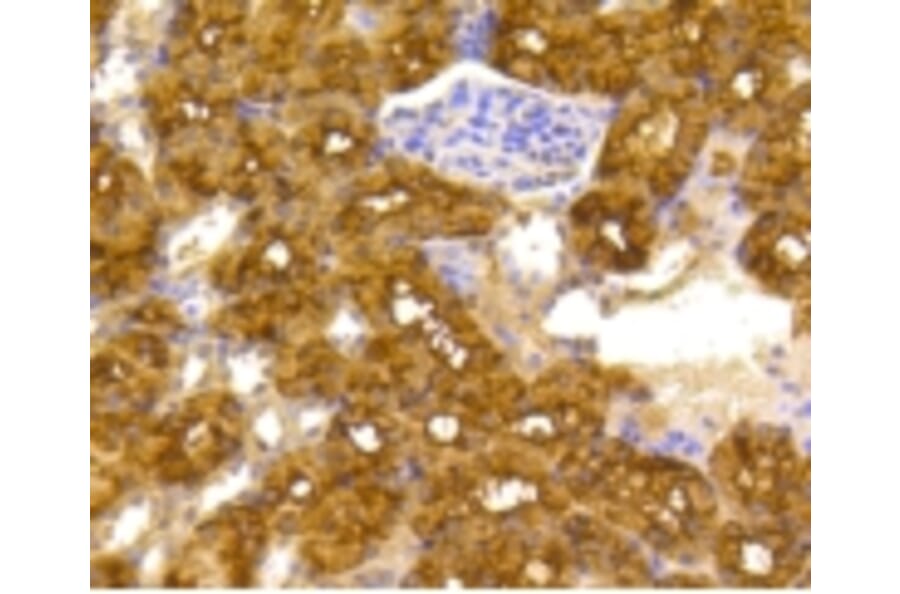 Anti-ATP-Citrate Lyase Antibody from Bioworld Technology (BS9934M) - Antibodies.com