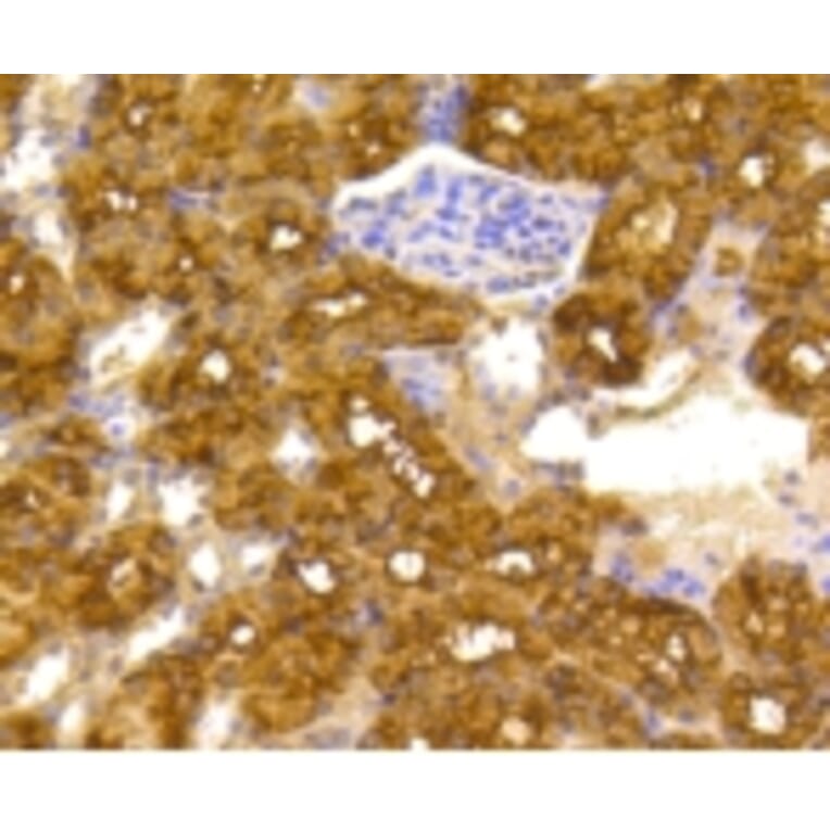 Anti-ATP-Citrate Lyase Antibody from Bioworld Technology (BS9934M) - Antibodies.com