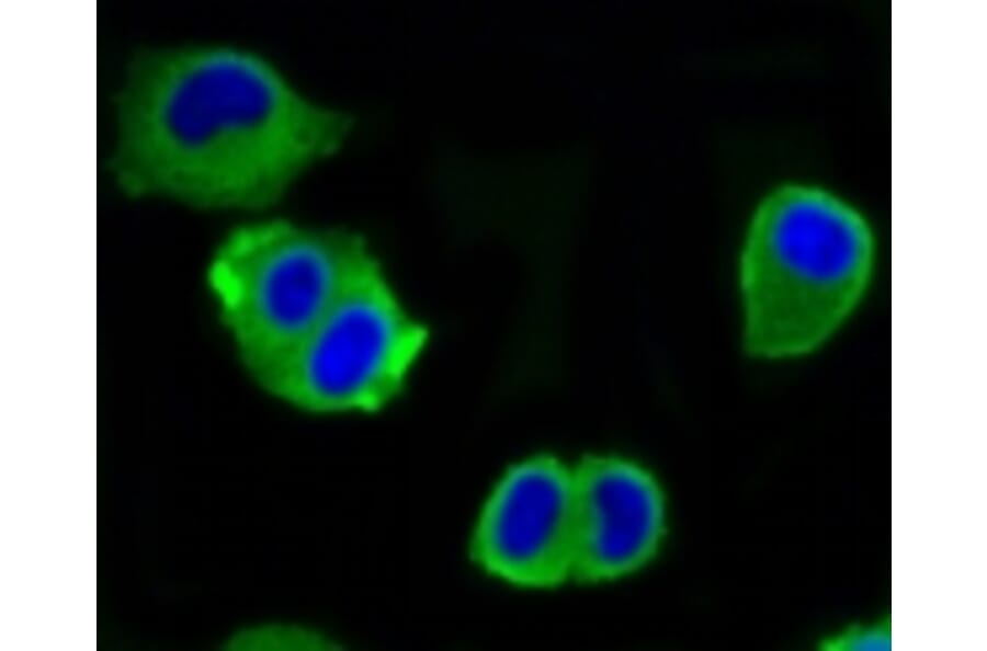 Anti-ATP-Citrate Lyase Antibody from Bioworld Technology (BS9934M) - Antibodies.com