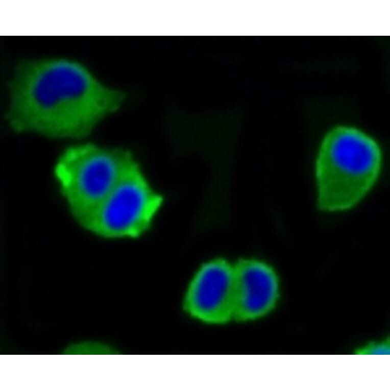 Anti-ATP-Citrate Lyase Antibody from Bioworld Technology (BS9934M) - Antibodies.com