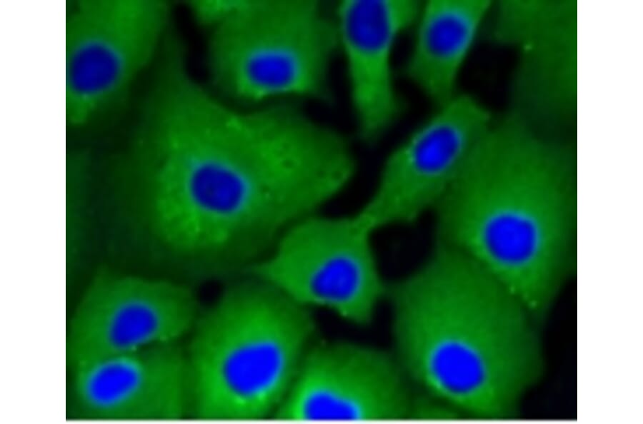 Anti-ATP-Citrate Lyase Antibody from Bioworld Technology (BS9934M) - Antibodies.com