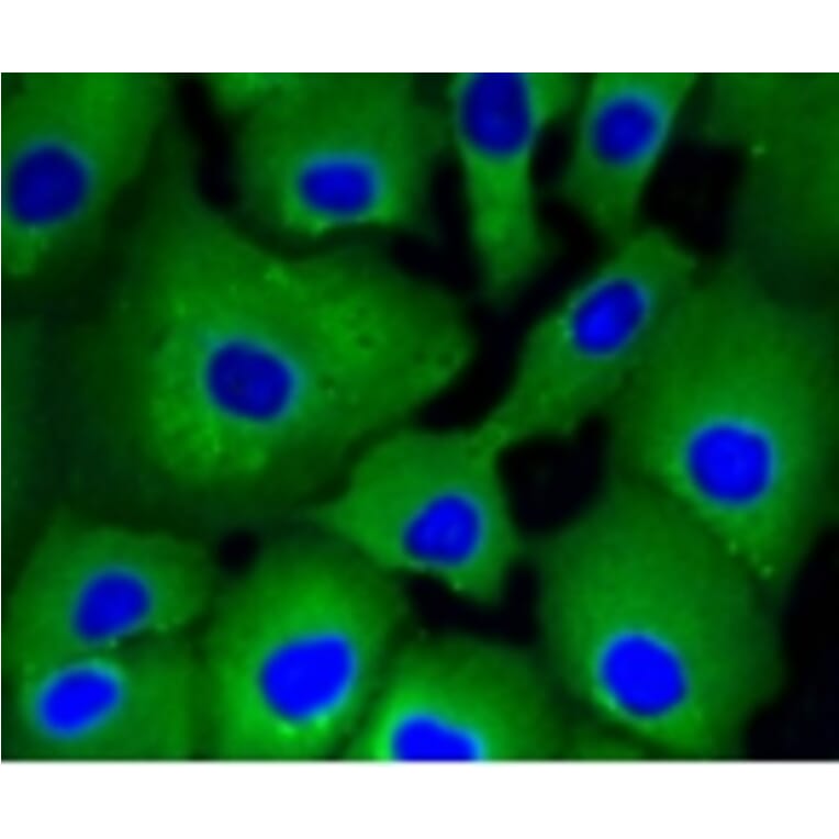 Anti-ATP-Citrate Lyase Antibody from Bioworld Technology (BS9934M) - Antibodies.com