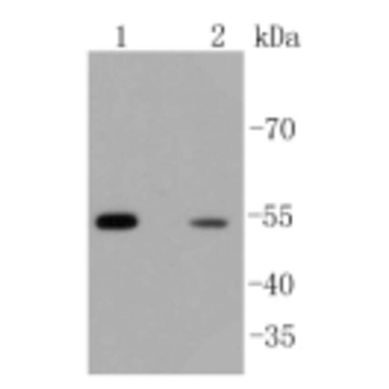 Anti-Arrestin-β-1 Antibody from Bioworld Technology (BS9935M) - Antibodies.com