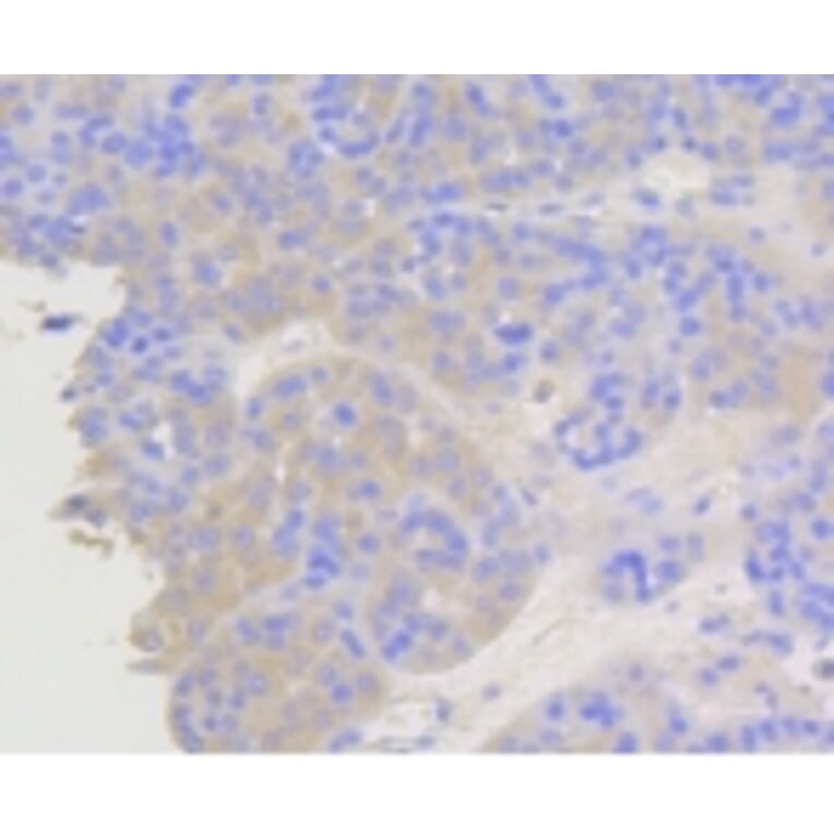 Anti-Arrestin-β-1 Antibody from Bioworld Technology (BS9935M) - Antibodies.com