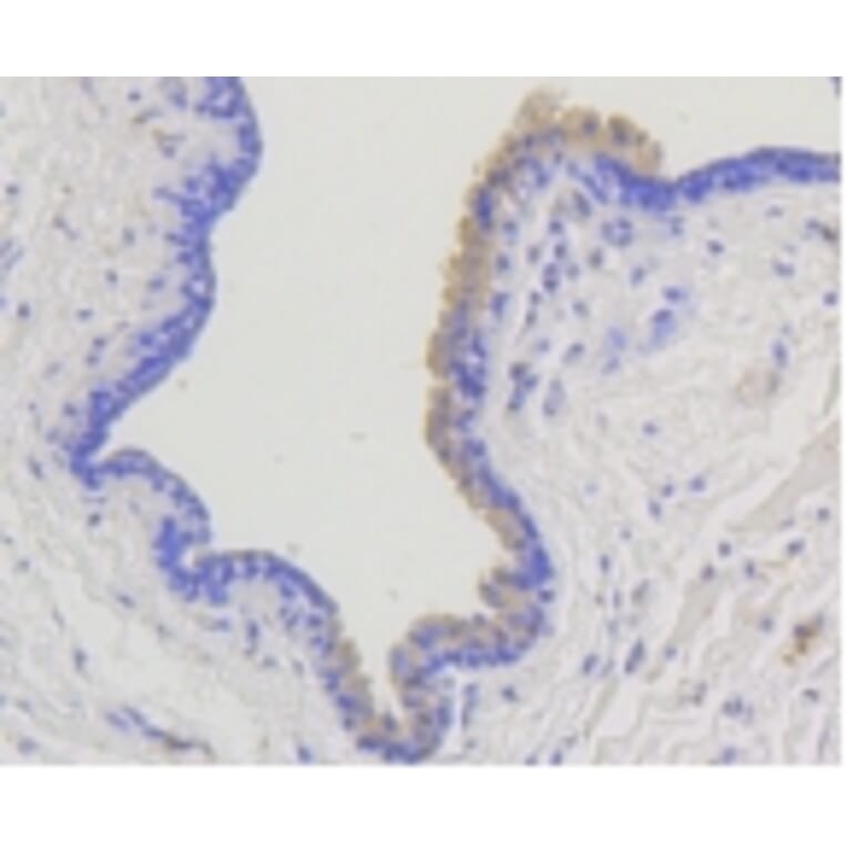 Anti-Arrestin-β-1 Antibody from Bioworld Technology (BS9935M) - Antibodies.com