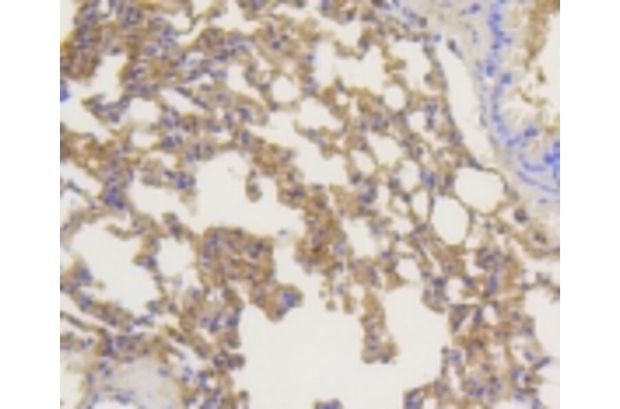 Anti-Arrestin-β-1 Antibody from Bioworld Technology (BS9935M) - Antibodies.com