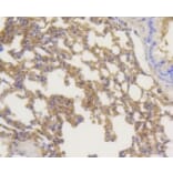 Anti-Arrestin-β-1 Antibody from Bioworld Technology (BS9935M) - Antibodies.com