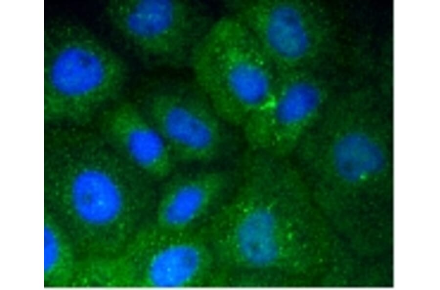 Anti-Vitronectin Antibody from Bioworld Technology (BS9936M) - Antibodies.com