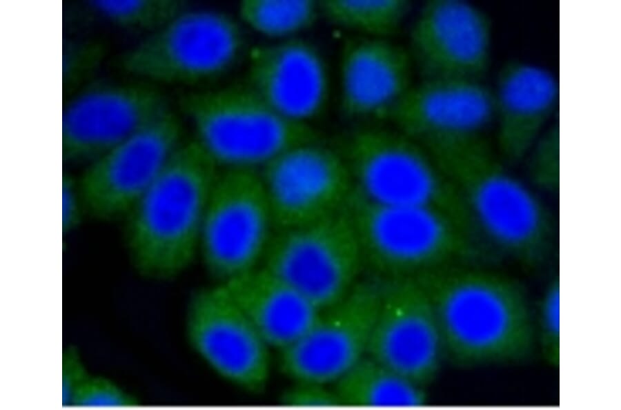 Anti-Vitronectin Antibody from Bioworld Technology (BS9936M) - Antibodies.com