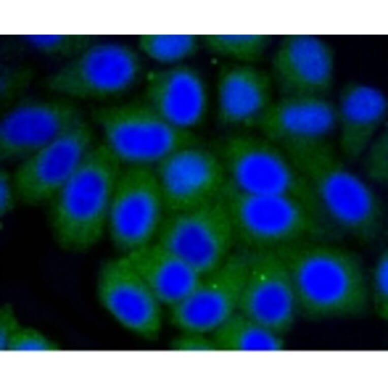 Anti-Vitronectin Antibody from Bioworld Technology (BS9936M) - Antibodies.com