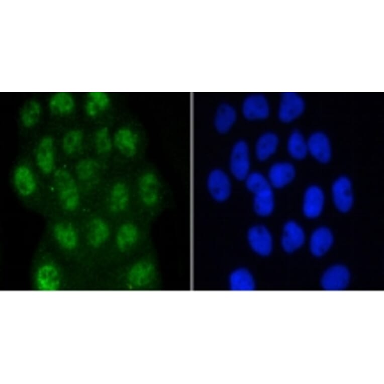 Anti-Smad3 (phospho-S423/S425) Antibody from Bioworld Technology (BS9938M) - Antibodies.com