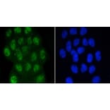 Anti-Smad3 (phospho-S423/S425) Antibody from Bioworld Technology (BS9938M) - Antibodies.com