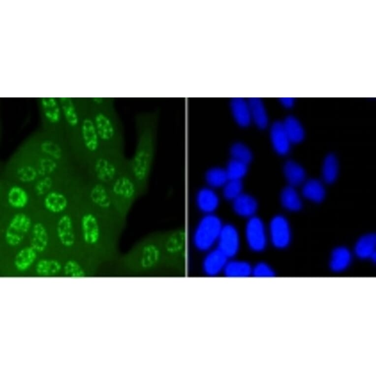 Anti-JNK1/2/3 (Phospho-T183) Antibody from Bioworld Technology (BS9939M) - Antibodies.com