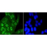 Anti-JNK1/2/3 (Phospho-T183) Antibody from Bioworld Technology (BS9939M) - Antibodies.com