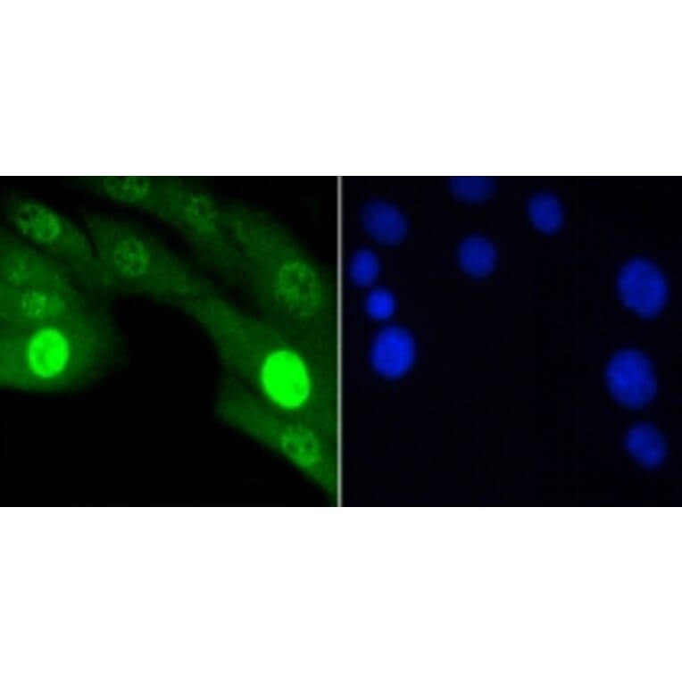 Anti-JNK1/2/3 (Phospho-T183) Antibody from Bioworld Technology (BS9939M) - Antibodies.com