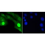 Anti-JNK1/2/3 (Phospho-T183) Antibody from Bioworld Technology (BS9939M) - Antibodies.com