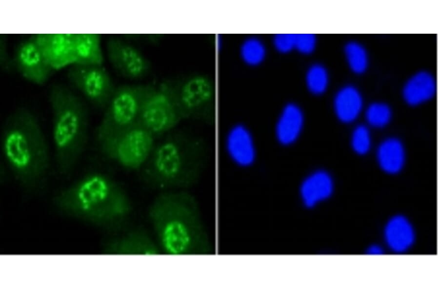 Anti-JNK1/2/3 (Phospho-T183) Antibody from Bioworld Technology (BS9939M) - Antibodies.com