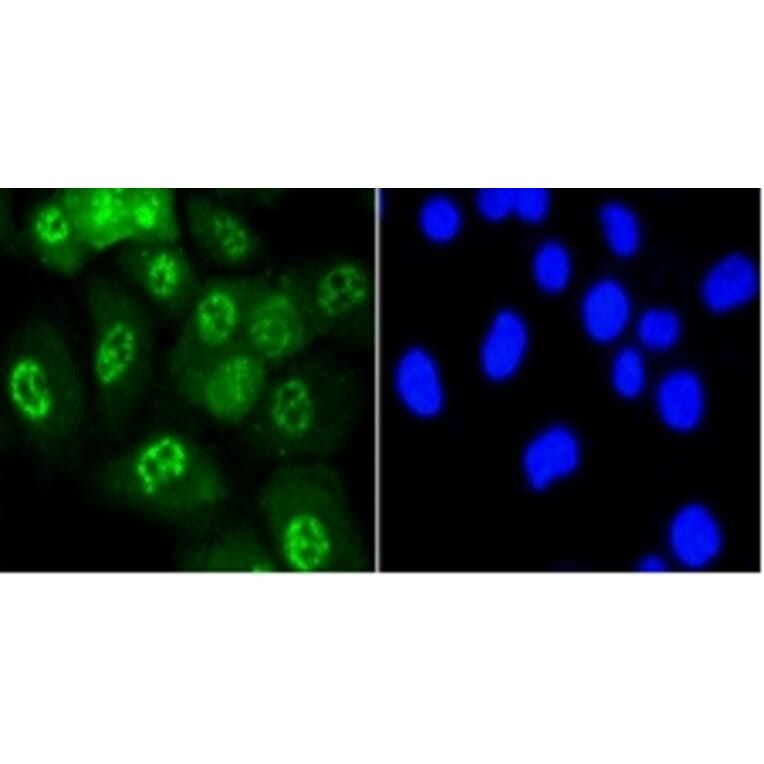 Anti-JNK1/2/3 (Phospho-T183) Antibody from Bioworld Technology (BS9939M) - Antibodies.com