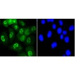 Anti-JNK1/2/3 (Phospho-T183) Antibody from Bioworld Technology (BS9939M) - Antibodies.com