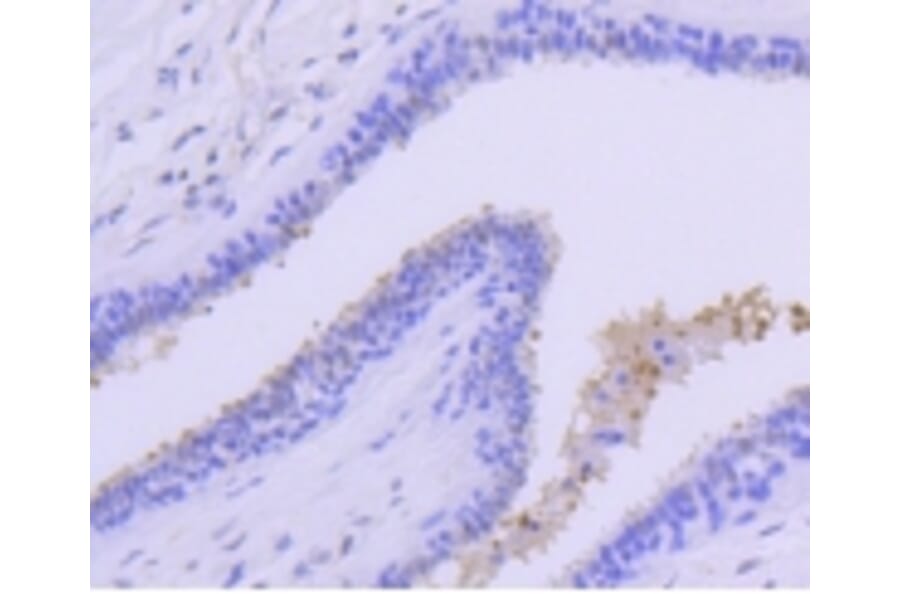 Anti-PRMT5 Antibody from Bioworld Technology (BS9940M) - Antibodies.com