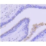 Anti-PRMT5 Antibody from Bioworld Technology (BS9940M) - Antibodies.com