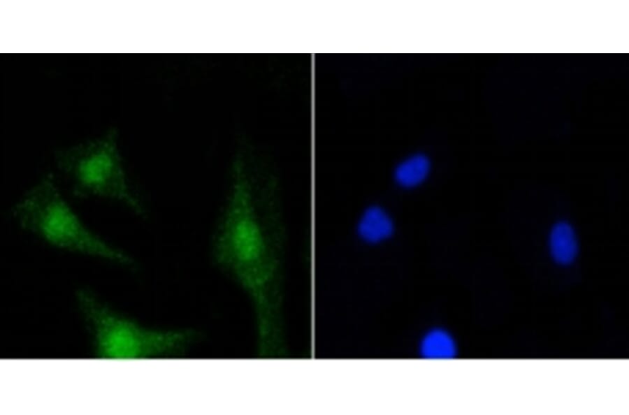 Anti-PKC β Antibody from Bioworld Technology (BS9941M) - Antibodies.com