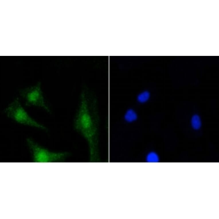 Anti-PKC β Antibody from Bioworld Technology (BS9941M) - Antibodies.com
