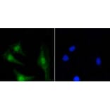 Anti-PKC β Antibody from Bioworld Technology (BS9941M) - Antibodies.com