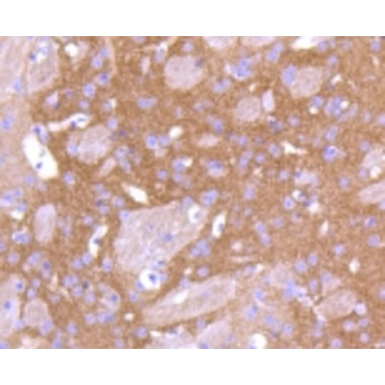 Anti-PKC β Antibody from Bioworld Technology (BS9941M) - Antibodies.com