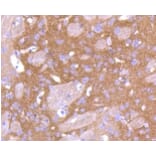 Anti-PKC β Antibody from Bioworld Technology (BS9941M) - Antibodies.com