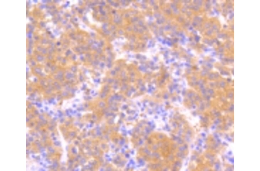 Anti-MEK1 (phospho-S218/S222) Antibody from Bioworld Technology (BS9945M) - Antibodies.com