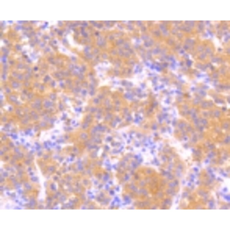 Anti-MEK1 (phospho-S218/S222) Antibody from Bioworld Technology (BS9945M) - Antibodies.com
