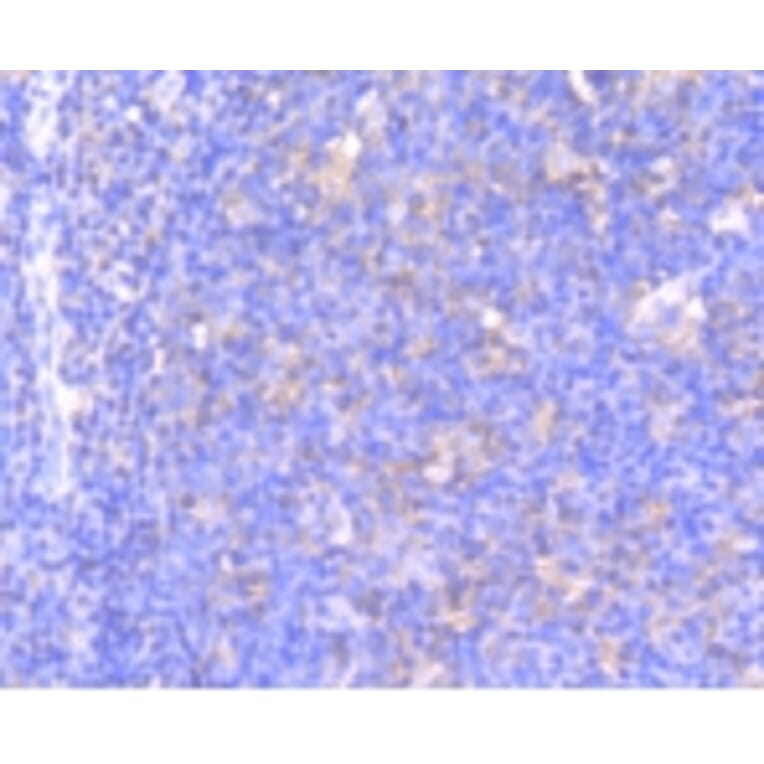Anti-MEK1 (phospho-S218/S222) Antibody from Bioworld Technology (BS9945M) - Antibodies.com