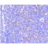 Anti-MEK1 (phospho-S218/S222) Antibody from Bioworld Technology (BS9945M) - Antibodies.com