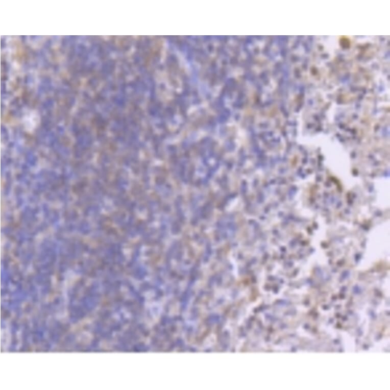 Anti-MEK1 (phospho-S218/S222) Antibody from Bioworld Technology (BS9945M) - Antibodies.com