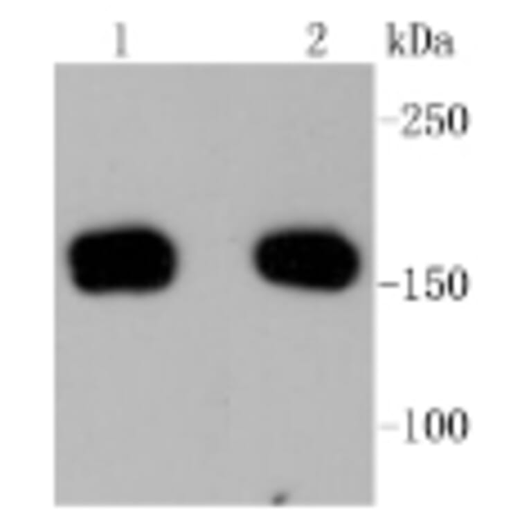 Anti-ROCK-1 Antibody from Bioworld Technology (BS9946M) - Antibodies.com