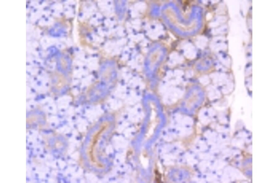 Anti-ROCK-1 Antibody from Bioworld Technology (BS9946M) - Antibodies.com