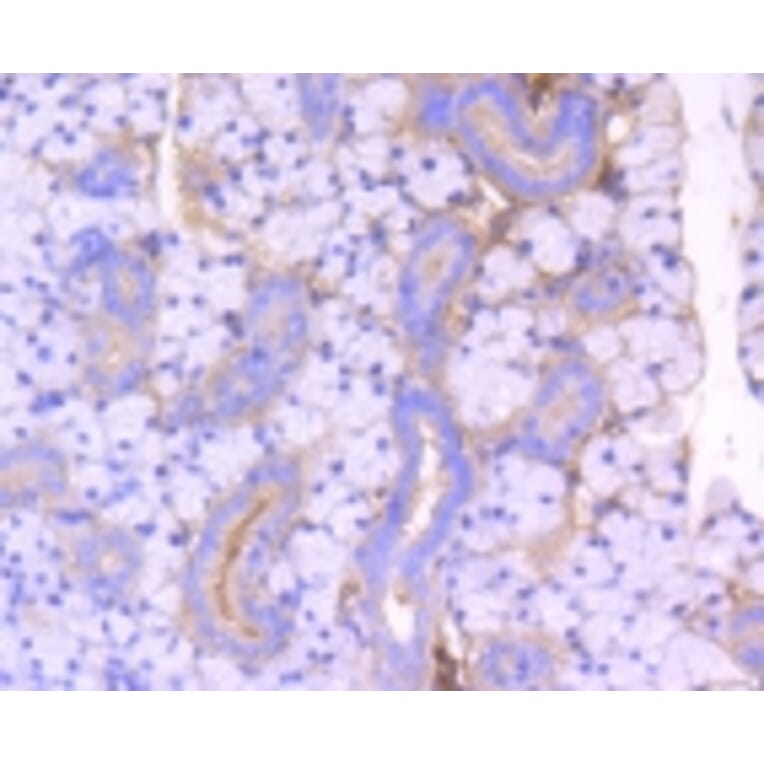 Anti-ROCK-1 Antibody from Bioworld Technology (BS9946M) - Antibodies.com