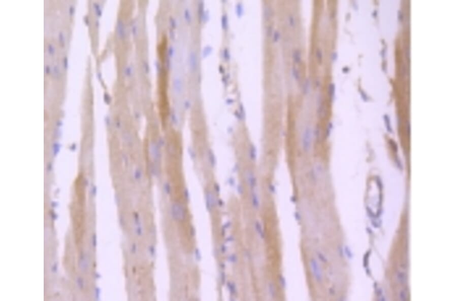 Anti-ROCK-1 Antibody from Bioworld Technology (BS9946M) - Antibodies.com